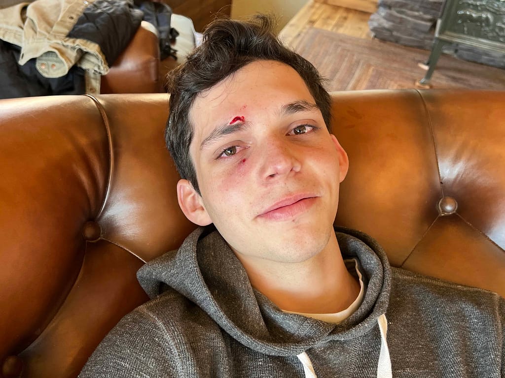 17 year old boy with a cut over his eye