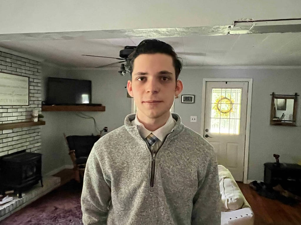 17 year old with wisdom teeth out