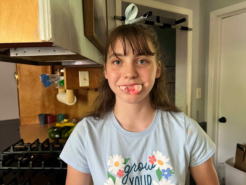 teen girl after teeth pulled