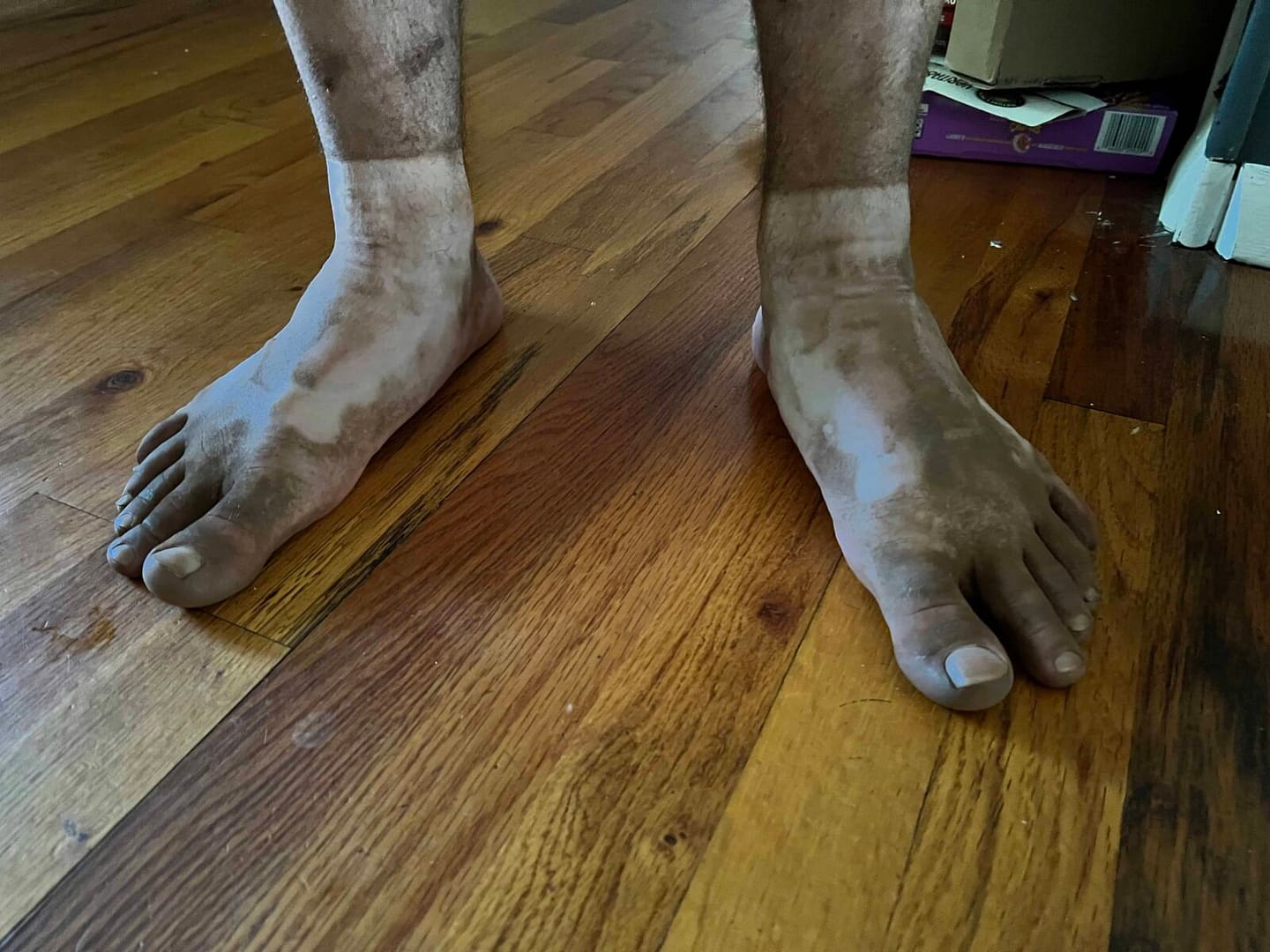 teen boy feet that are really dirty
