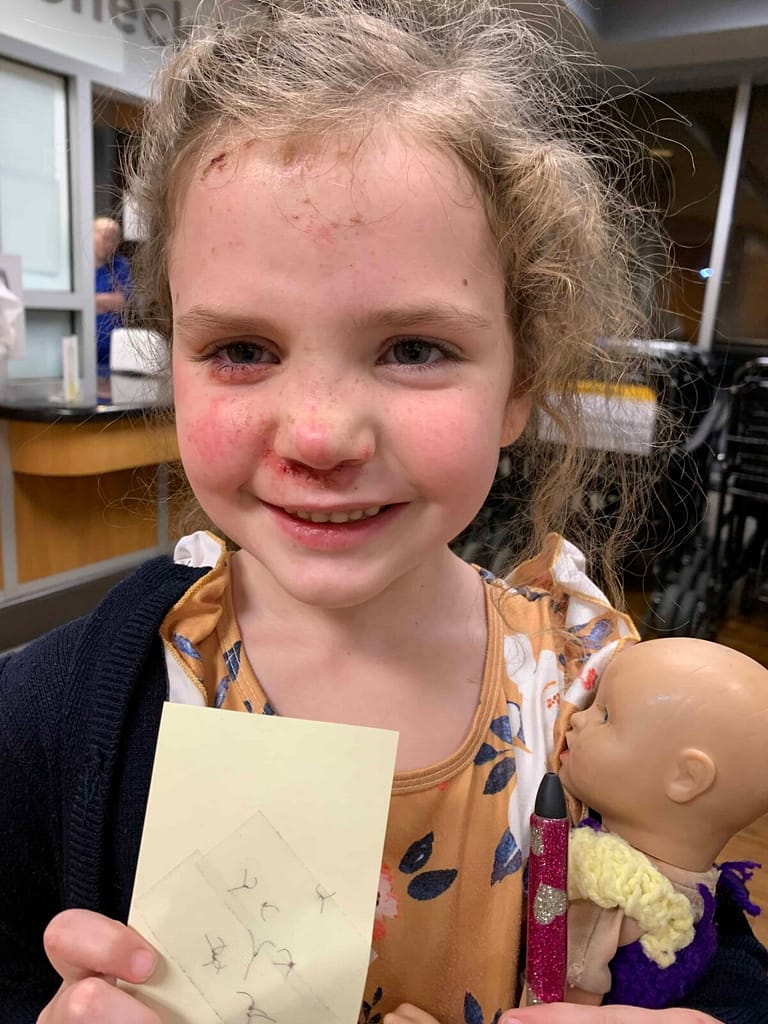 6 year old girl with her stitches just out