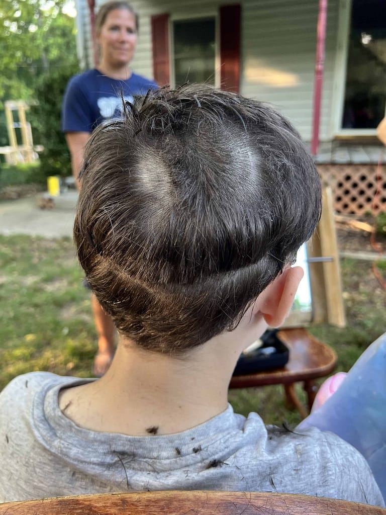 back of head with happy face cut into it