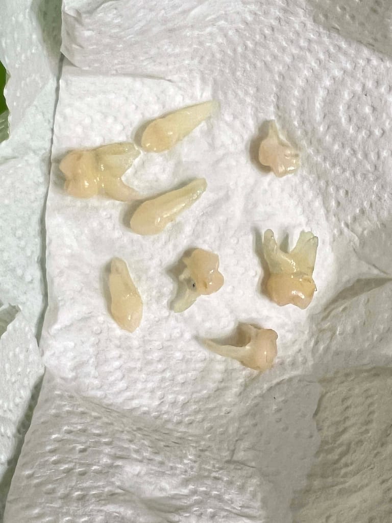 8 teeth